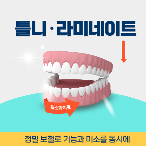청주치과 청주시 치과 틀니 라미네이트