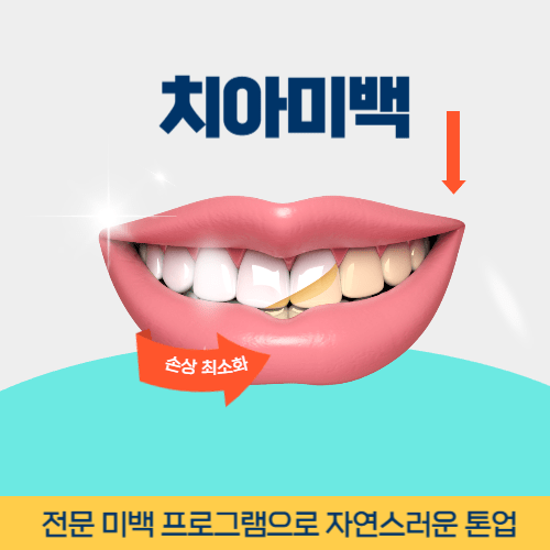 청주치과 청주시 치과 치아미백