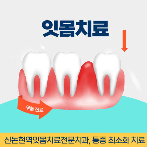 청주치과 청주시 치과 잇몸치료
